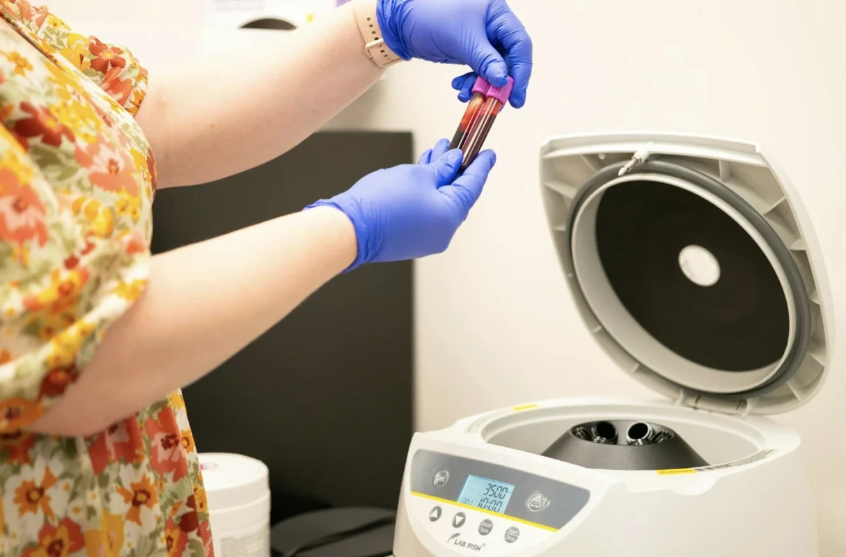 Iron scantness – Anemia