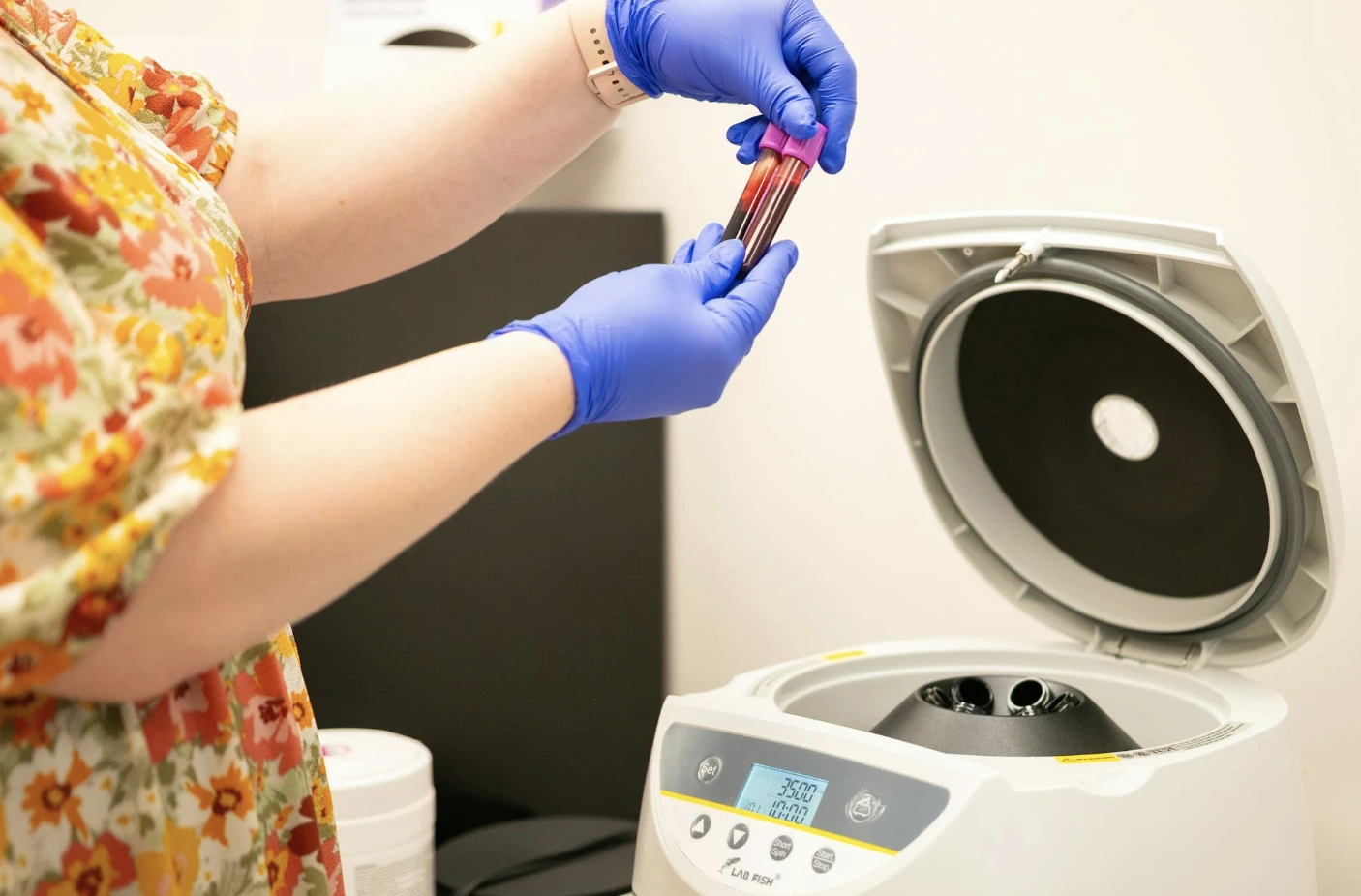 Iron scantness – Anemia